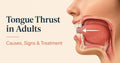 Tongue Thrust in Adults: Causes, Symptoms & Treatment (Ottawa Guide)